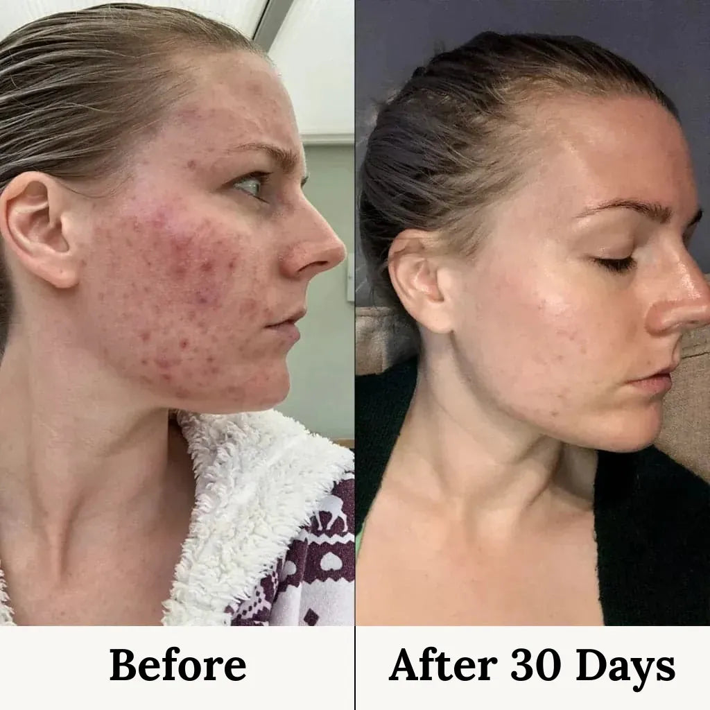 Opalènne Hydrolized Marine Collagen